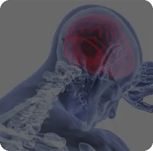 Dothan, Alabama, Chiropractic Treatment of Headaches